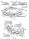 Fig. 02 - Intra-abdominal medical method and associated device