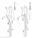 Fig. 18 - Embolic protection filter with reduced landing zone