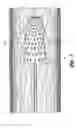 Fig. 04 - Embolic protection device