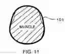 Fig. 07 - Device for building up muscle