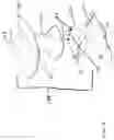 Fig. 04 - Methods and apparatus for a manual vascular compression device