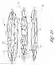 Fig. 16 - Method and apparatus for impeding migration of an implanted occlusive structure