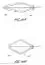 Fig. 40 - Method and apparatus for impeding migration of an implanted occlusive structure