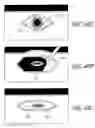 Fig. 44 - Method and apparatus for impeding migration of an implanted occlusive structure