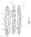 Fig. 16 - Method and apparatus for implanting an occlusive structure