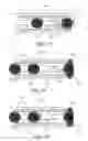 Fig. 19 - Method and apparatus for implanting an occlusive structure