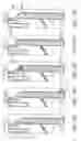 Fig. 33 - Method and apparatus for implanting an occlusive structure