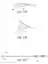 Fig. 55 - Method and apparatus for implanting an occlusive structure