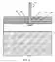 Fig. 03 - Method and a medical closure system for sealing a puncture