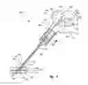 Fig. 07 - Tissue puncture closure device with scroll gear transmission tamping system