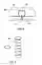 Fig. 11 - Anchoring System for Valve Replacement