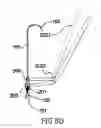 Fig. 15 - Anchoring System for Valve Replacement