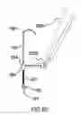 Fig. 16 - Anchoring System for Valve Replacement