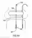 Fig. 18 - Anchoring System for Valve Replacement