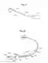 Fig. 09 - Power supply for an implantable subcutaneous cardioverter-defibrillator