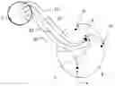 Fig. 01 - Heart stimulator with stimulation control dependent on perfusion blood flow