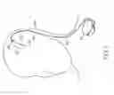Fig. 02 - Monopolar stimulation assembly including at least one remote electrode