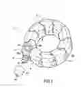 Fig. 02 - Gastric ring