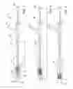 Fig. 02 - Catheter