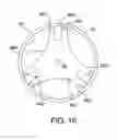 Fig. 09 - Catheter