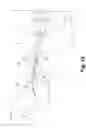Fig. 02 - Stent-stabilizing device
