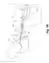 Fig. 03 - Stent-stabilizing device