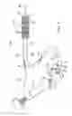 Fig. 02 - Custom-length stent delivery system with independently operable expansion elements