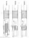 Fig. 10 - Custom-length stent delivery system with independently operable expansion elements