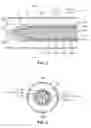 Fig. 02 - Staged deployment endograft