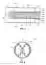 Fig. 04 - Staged deployment endograft