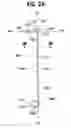 Fig. 03 - Ureteral stent