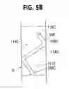 Fig. 08 - Ureteral stent