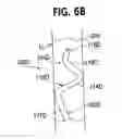 Fig. 09 - Ureteral stent