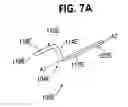 Fig. 10 - Ureteral stent