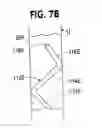 Fig. 11 - Ureteral stent