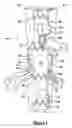 Fig. 02 - Vascular endograft