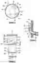 Fig. 03 - Vascular endograft
