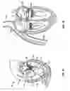 Fig. 02 - Methods, systems and devices for cardiac valve repair