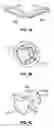 Fig. 05 - Methods, systems and devices for cardiac valve repair