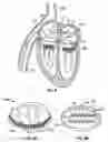 Fig. 08 - Methods, systems and devices for cardiac valve repair
