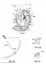 Fig. 10 - Methods, systems and devices for cardiac valve repair