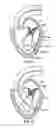 Fig. 11 - Methods, systems and devices for cardiac valve repair