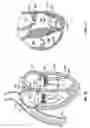 Fig. 12 - Methods, systems and devices for cardiac valve repair