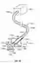 Fig. 18 - Methods, systems and devices for cardiac valve repair