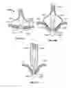 Fig. 19 - Methods, systems and devices for cardiac valve repair