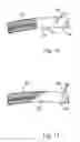 Fig. 07 - Vascular graft