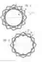 Fig. 03 - Covered stent with encapsulated ends