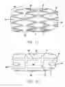 Fig. 08 - Covered stent with encapsulated ends