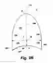 Fig. 04 - Replacement aortic valve leaflets and related technology