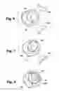 Fig. 14 - Replacement aortic valve leaflets and related technology